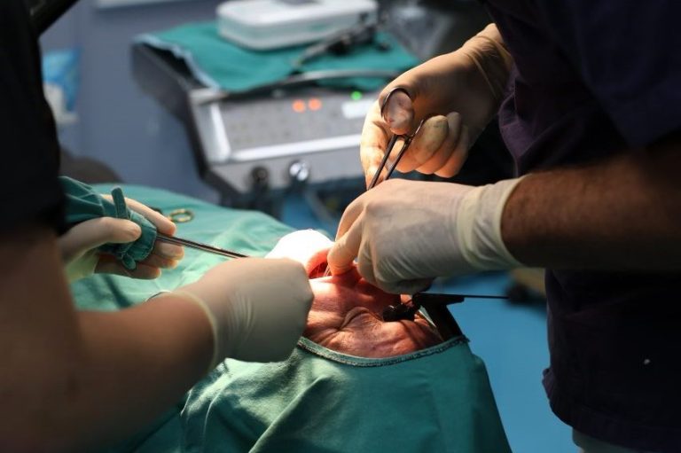 Kirurgji orale dhe implante në Klinikën AlbDental