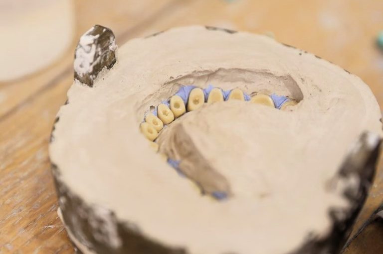 Laboratori dentar dixhital në Klinikën AlbDental