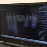 Laboratori dentar dixhital në Klinikën AlbDental