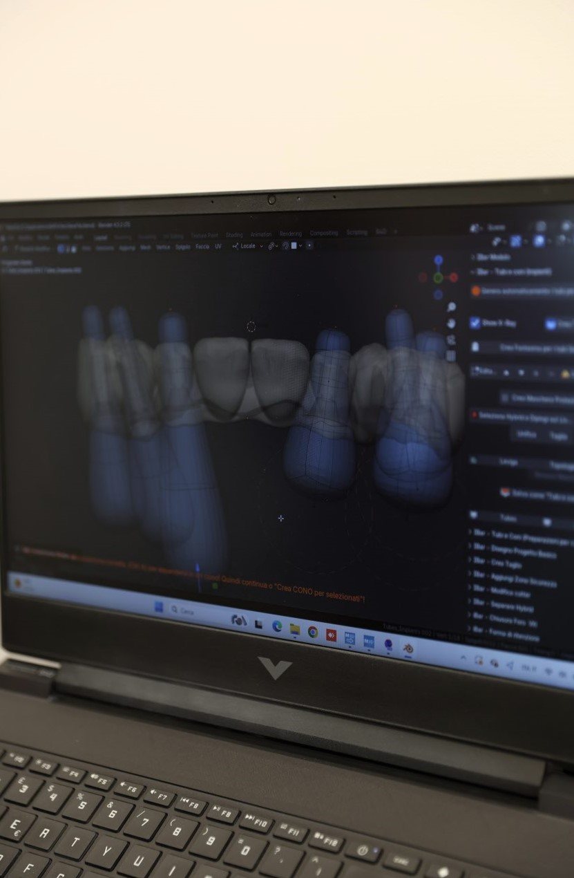 Laboratori dentar dixhital në Klinikën AlbDental