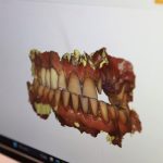 Laboratori dentar dixhital në Klinikën AlbDental