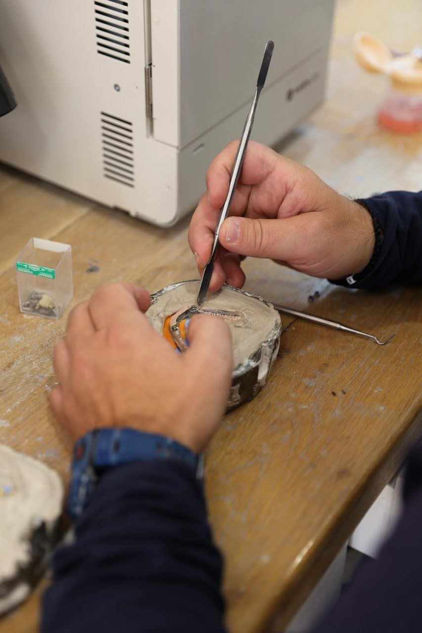 Laboratori dentar dixhital në Klinikën AlbDental