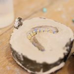 Laboratori dentar dixhital në Klinikën AlbDental