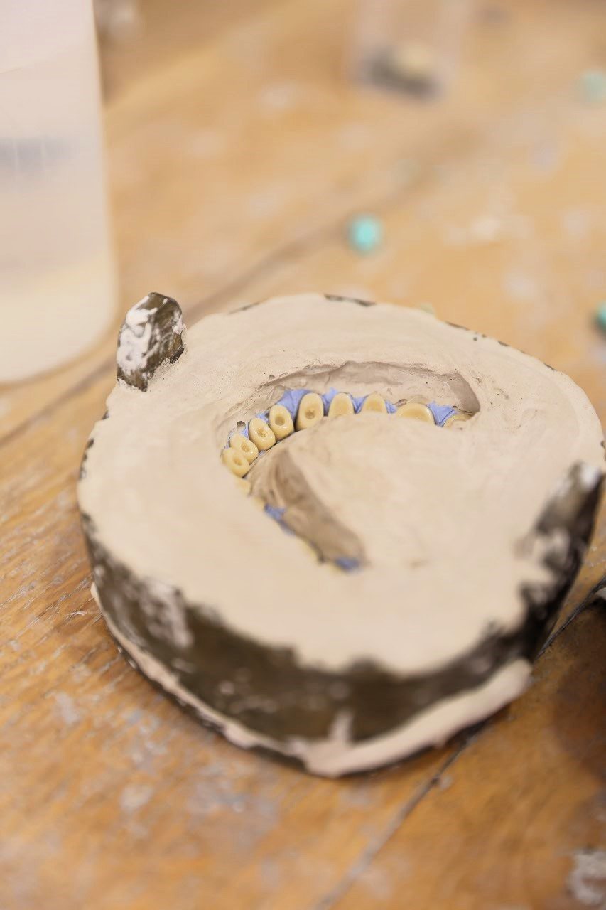 Laboratori dentar dixhital në Klinikën AlbDental