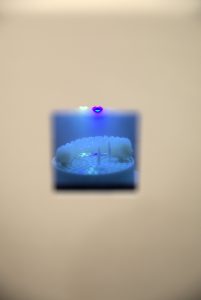 Laboratori dentar dixhital në Klinikën AlbDental