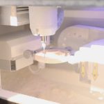 Laboratori dentar dixhital në Klinikën AlbDental