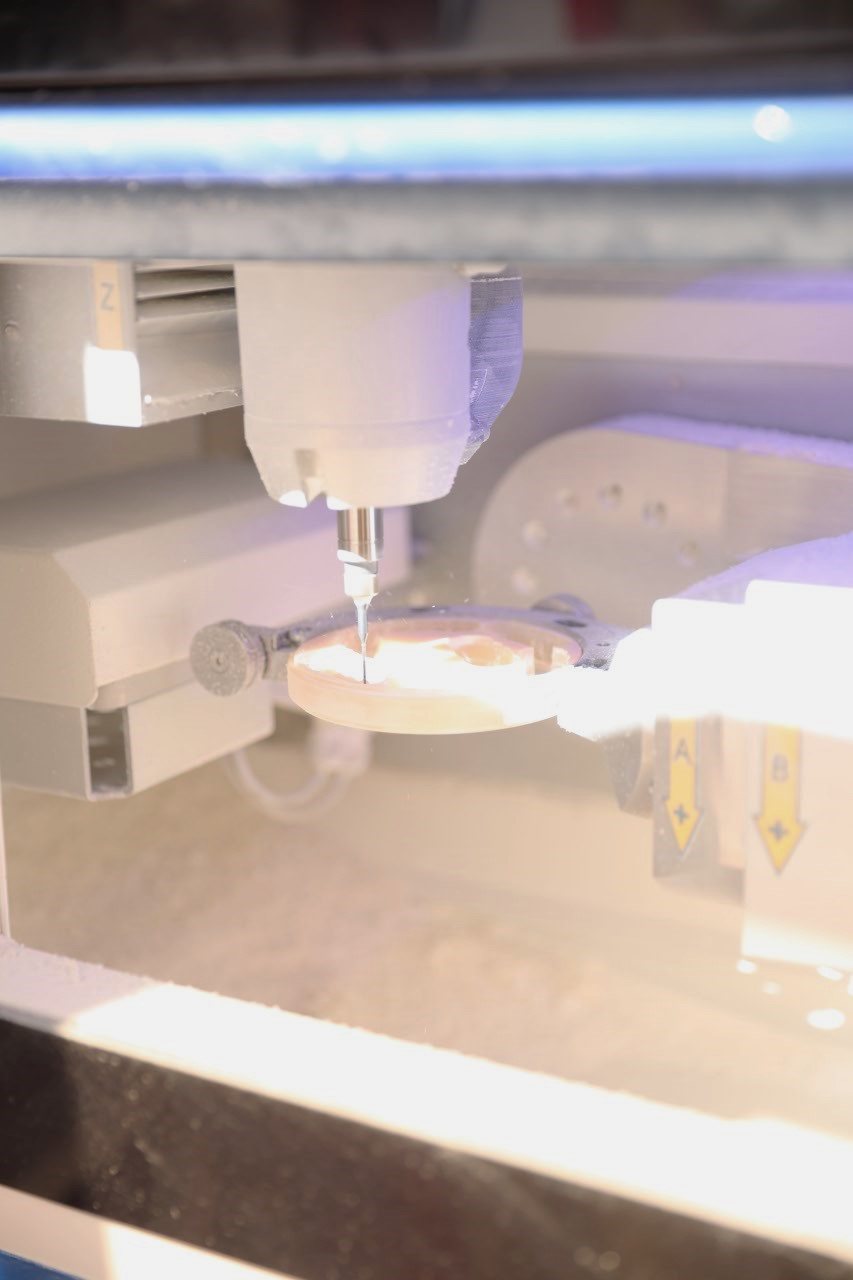Laboratori dentar dixhital në Klinikën AlbDental