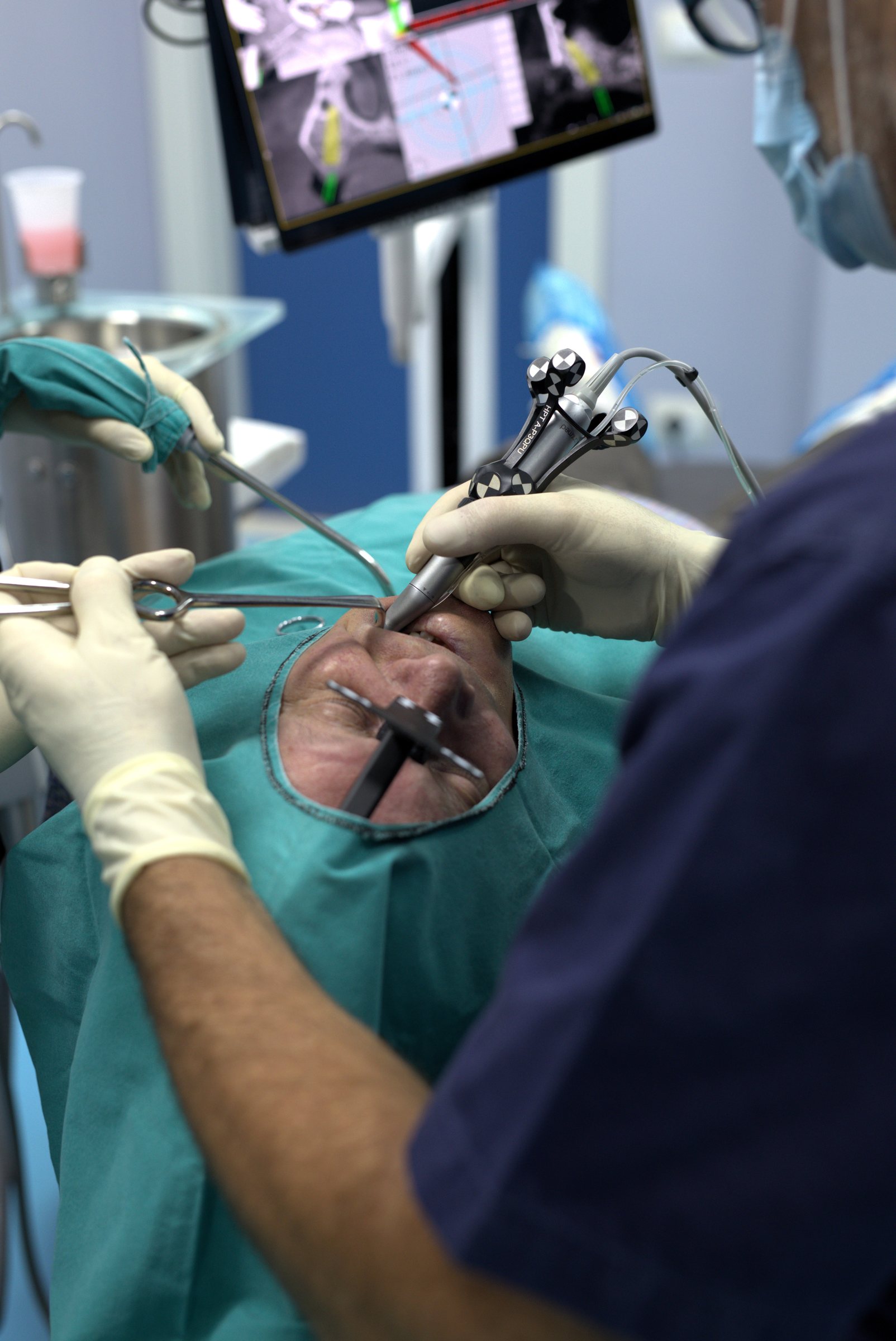 Kirurgji orale dhe implante në Klinikën AlbDental