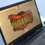 Laboratori dentar dixhital në Klinikën AlbDental