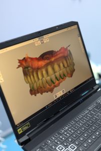 Laboratori dentar dixhital në Klinikën AlbDental