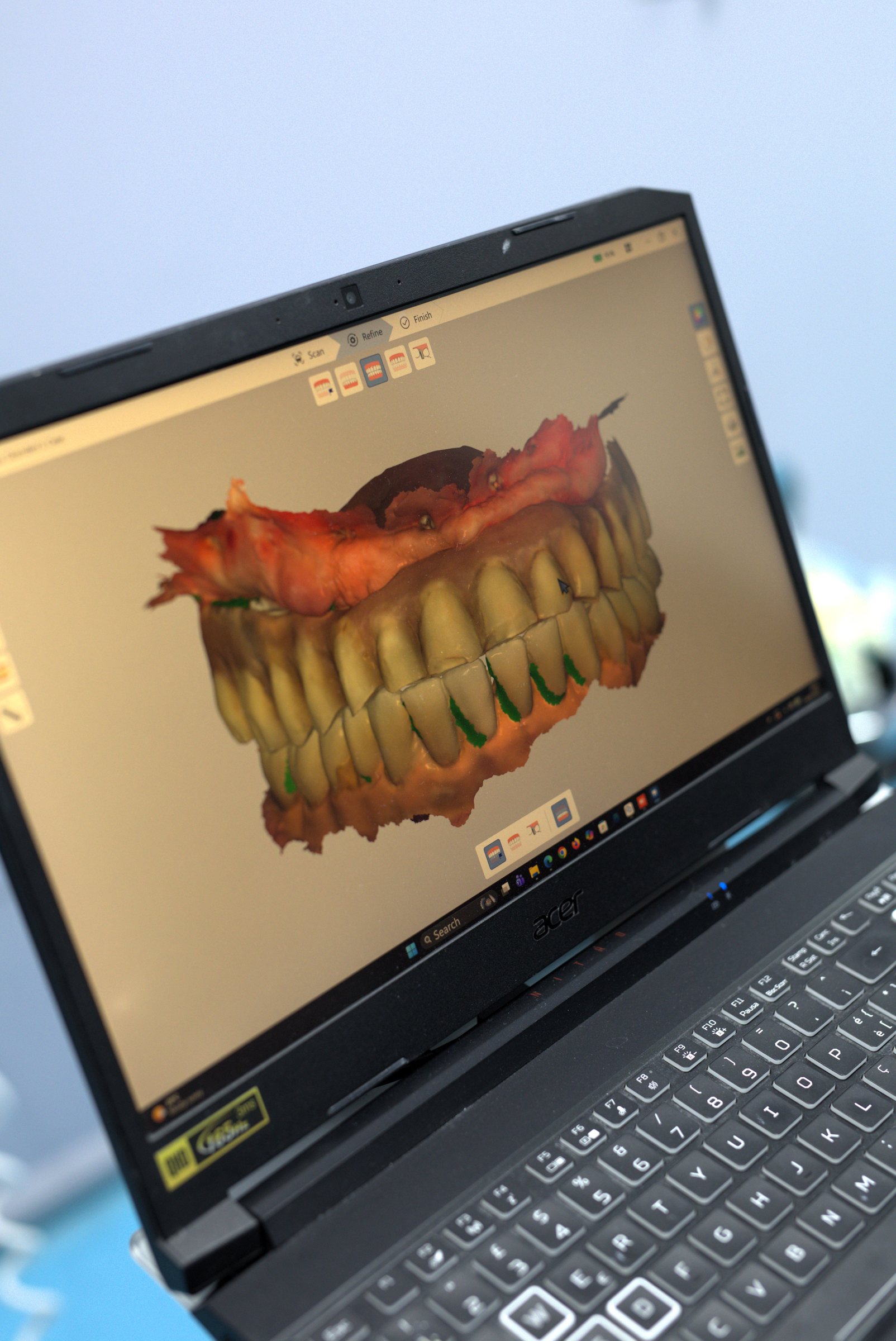 Laboratori dentar dixhital në Klinikën AlbDental