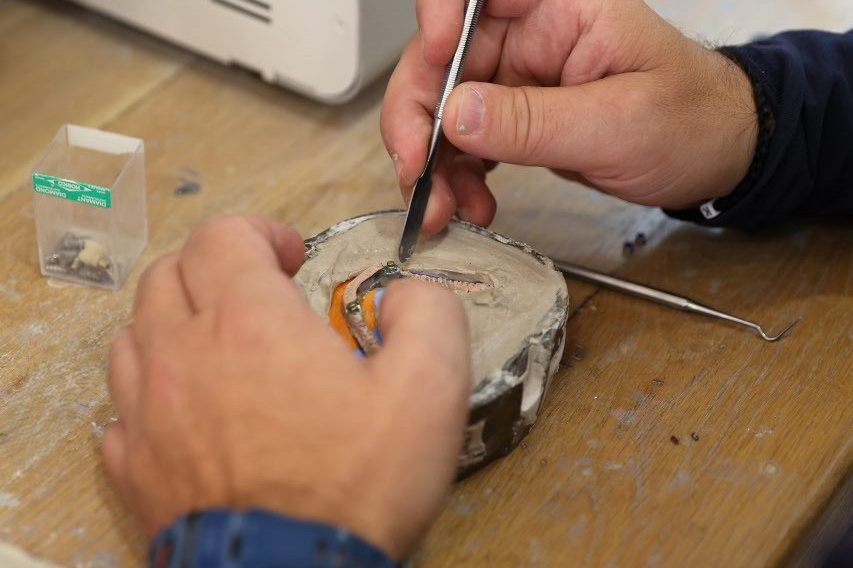 Punim laboratorik i personalizuar